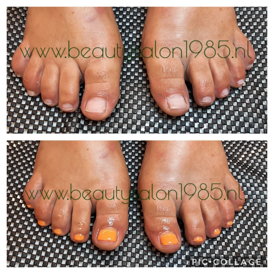 photo - Beautysalon 1985 - Pedicure leiden - Bdr huidverbetering